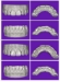 Picture of cameo Dental CAD Base Module