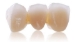 Picture of AxZir ST-Color Shaded Dental Zirconia