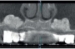 Picture of Polident X-ray CAD-CAM Discs