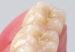 Picture of REF-LINE Posterior Teeth