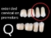 Picture of REF-LINE Posterior Teeth