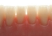 Picture of REF-LINE Upper Anterior Teeth