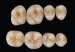 Picture of REF-LINE Posterior Teeth