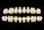 Picture of CROSS LINKED 2 Posterior Teeth