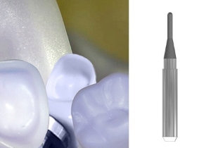 Picture of Versamill ax200/450/500 OEM Glass Ceramic Tool D2.5xR1.25xLn12xOL50 Electroplated Diamond Coated Ballnose Grinding Bur.